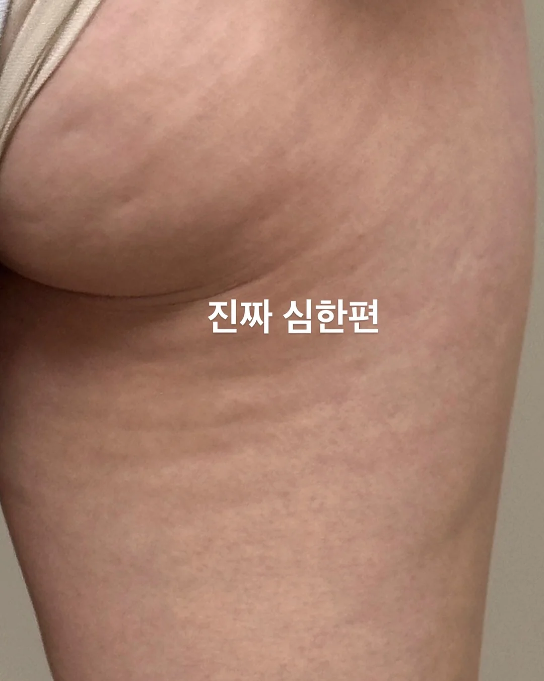 플립플랍 8