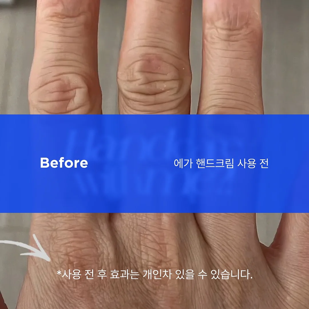 재생 3종 5