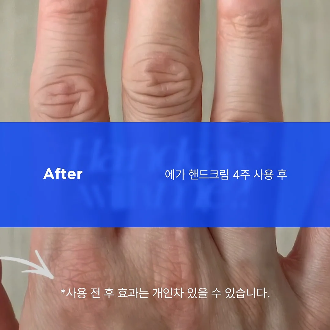 재생 3종 6