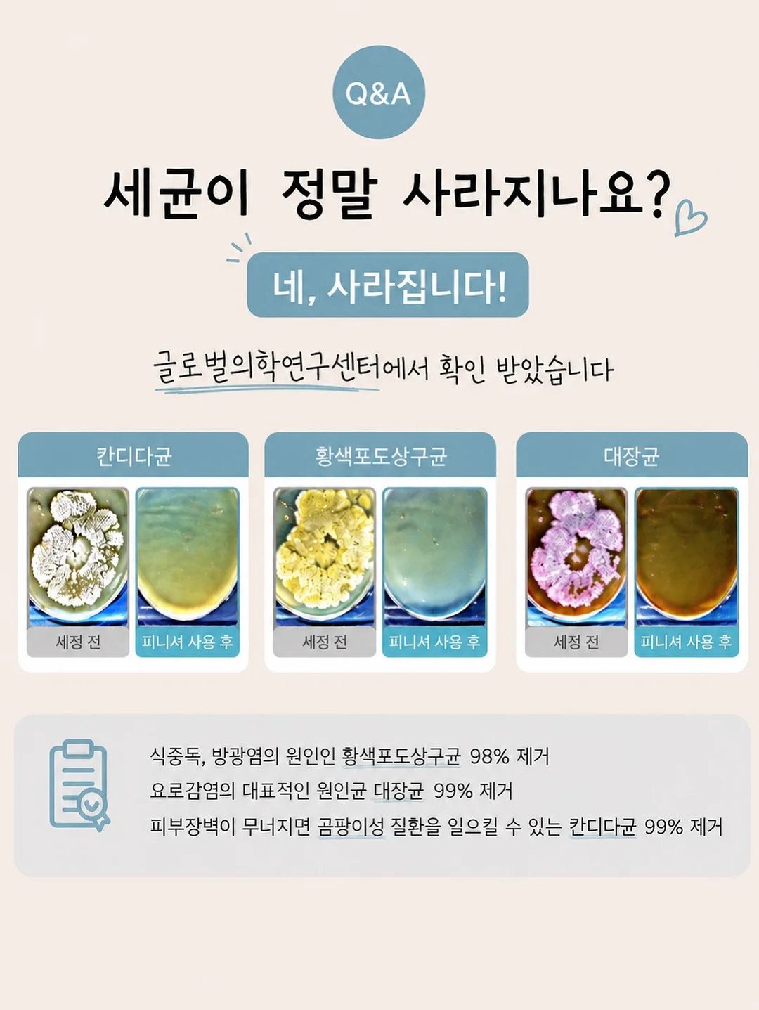 아케이 이염방지시트 10