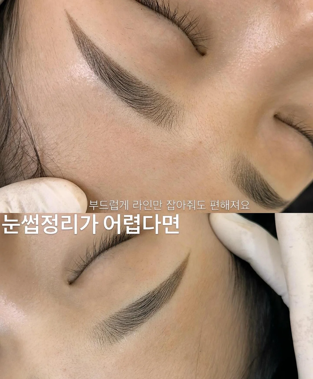 붓기 케어 4