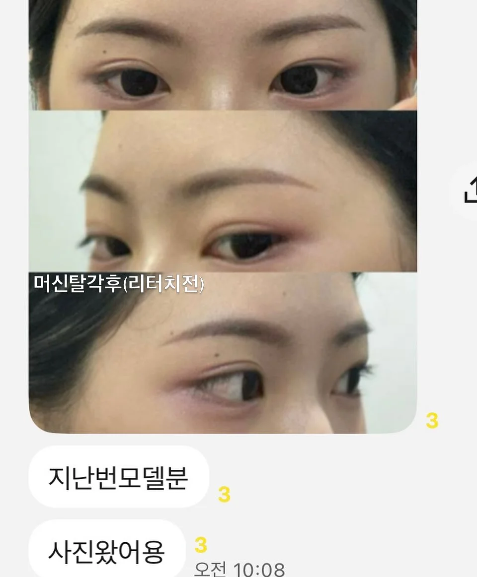 붓기 케어 6