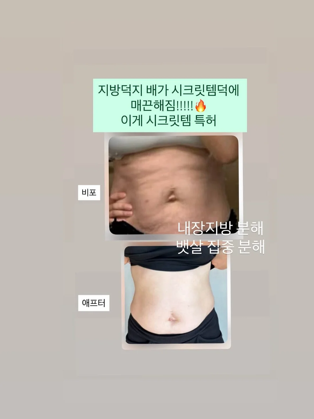 쌀 보관 용기 6
