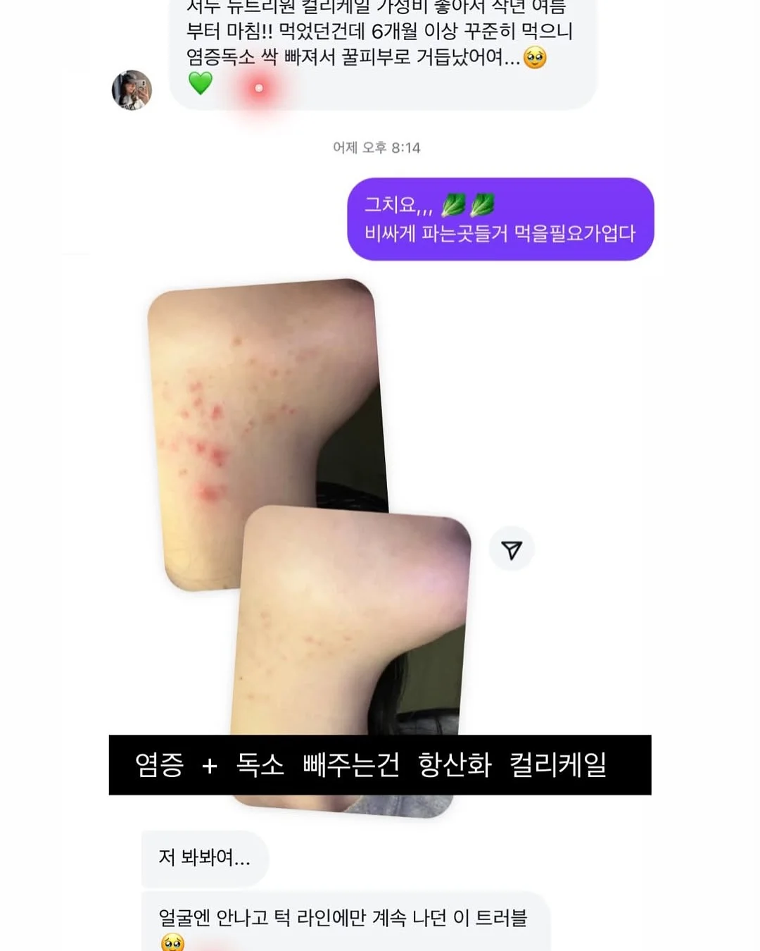 차량용 매트 6