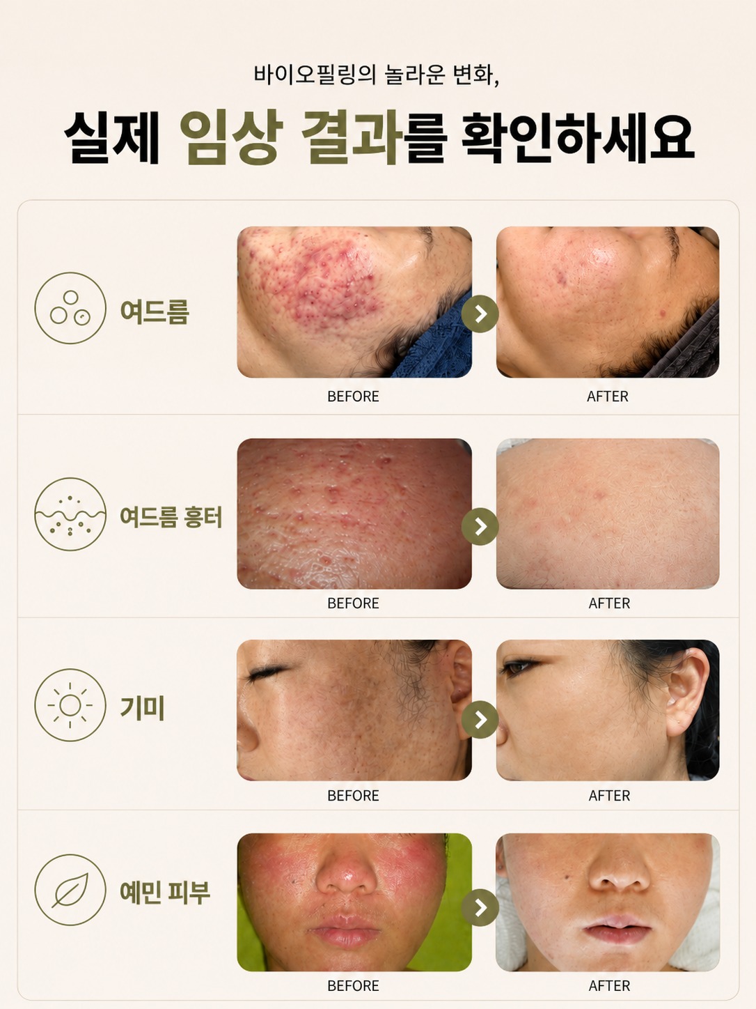 초코 플라워 바디수트 + 모자 세트 4