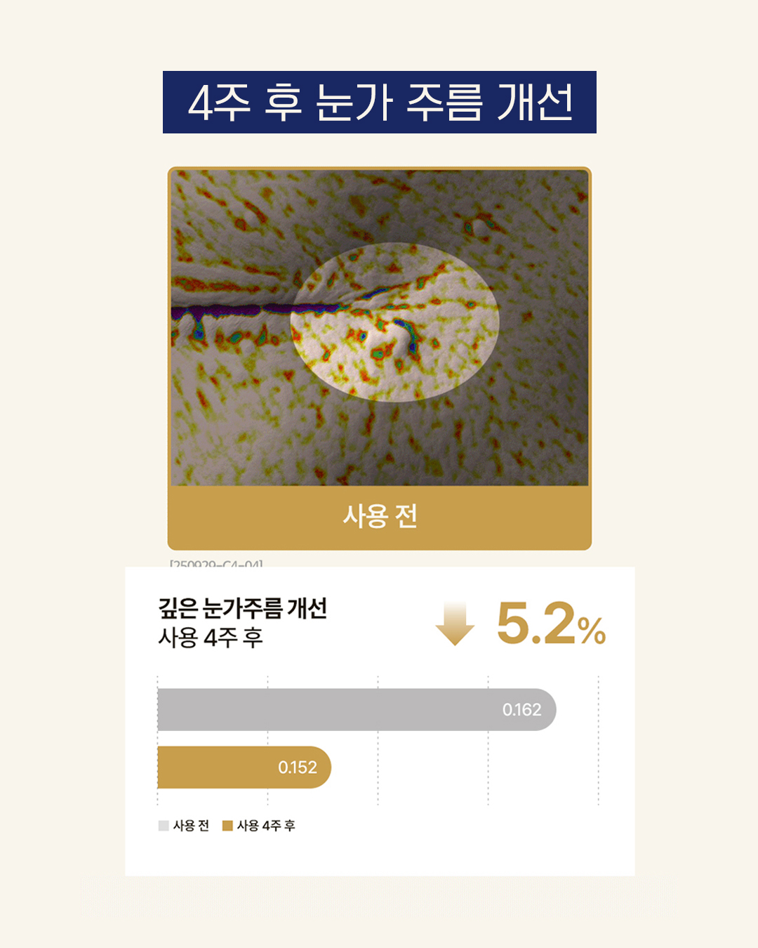 박스반팔 4