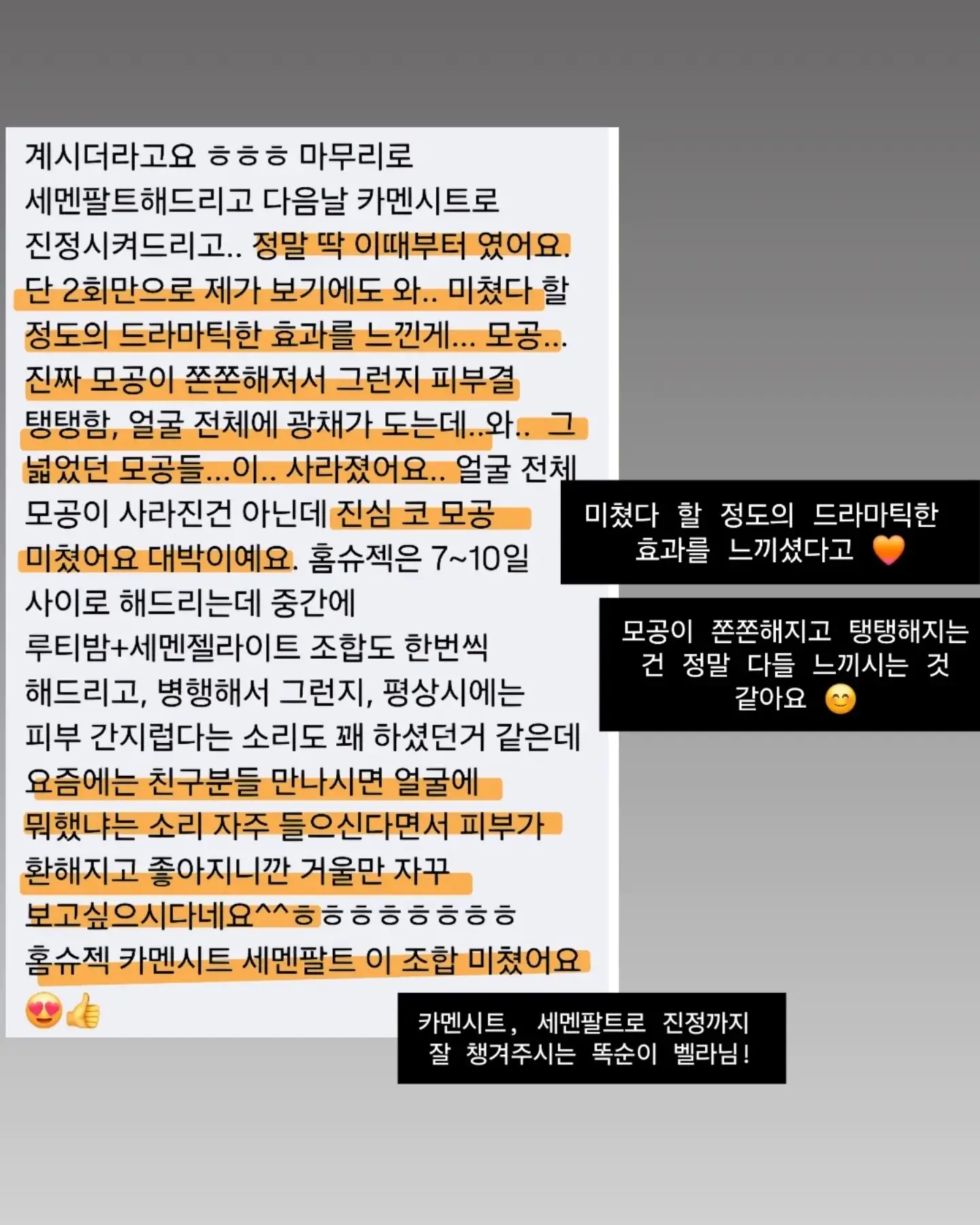 발렌리본탑과 니트미디스커트 세트 14