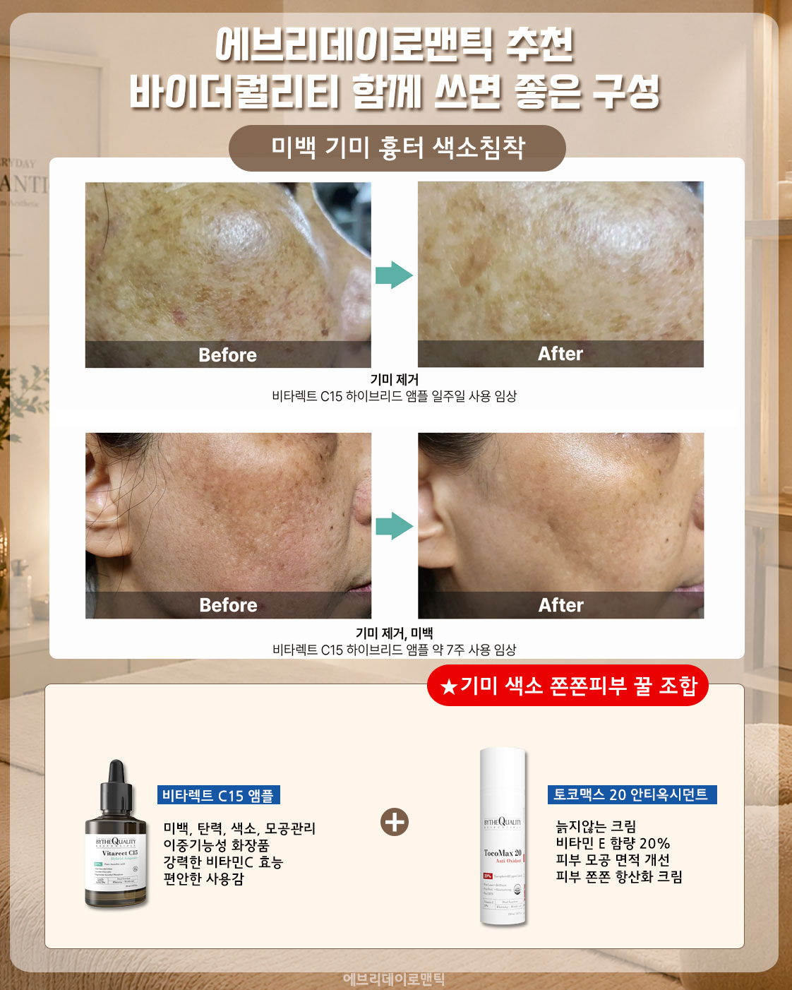 치과놀이 1