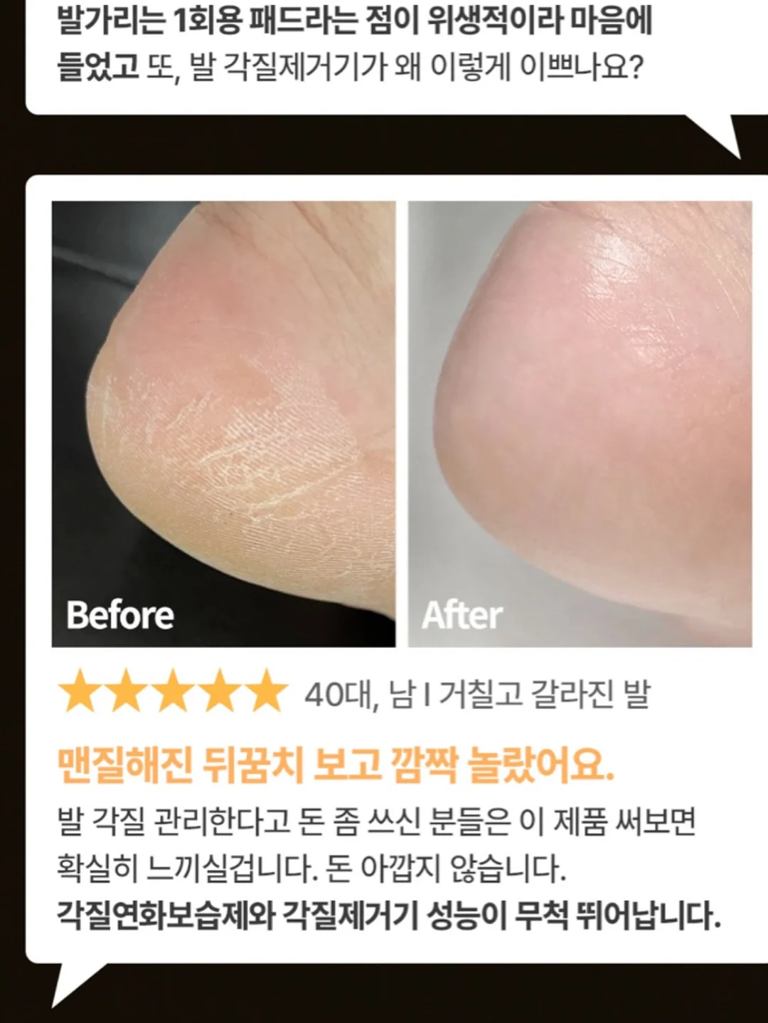 차량용 세척기 11