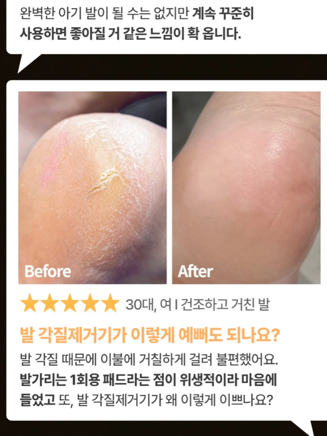 차량용 세척기 10